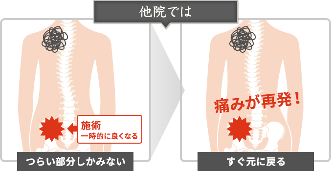他院での施術方法